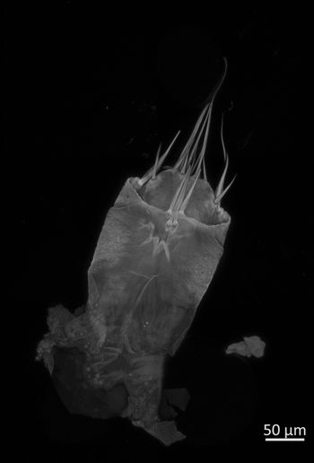 Media type: image;   Invertebrate Zoology 162243 Aspect: Stitched Projection